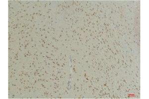 Immunohistochemical analysis of paraffin-embedded Mouse BrainTissue using GABA Transporter 1 Rabbit pAb diluted at 1:200. (SLC6A1 anticorps)