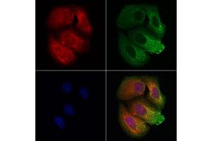 ABIN7093832 and ABIN7097875 staining Hela cells by IF/ICC. (BBS9 anticorps  (C-Term))
