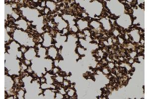 ABIN6278855 at 1/100 staining Mouse lung tissue by IHC-P.