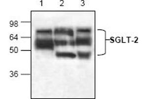 Image no. 1 for anti-Solute Carrier Family 5 (Sodium/glucose Cotransporter), Member 2 (SLC5A2) (N-Term) antibody (ABIN155150) (SLC5A2 anticorps  (N-Term))