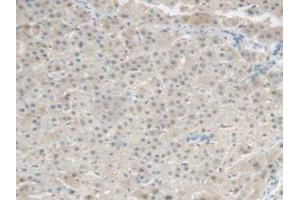 IHC-P analysis of Human Liver Tissue, with DAB staining. (CRP anticorps  (AA 17-224))