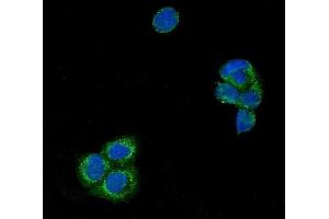 IF analysis of USP21 using anti-USP21 antibody (ABIN7601053). (USP21 anticorps  (AA 277-565))