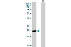 Western Blot analysis of NME6 expression in transfected 293T cell line by NME6 MaxPab polyclonal antibody. (NME6 anticorps  (AA 1-194))