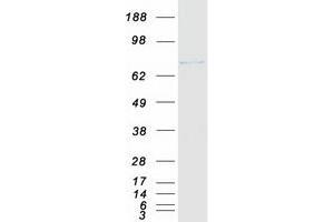 Validation with Western Blot