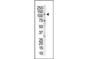 The anti-FGFR1 Pab (ABIN1882081 and ABIN2841755) is used in Western blot to detect FGFR1 in NIH-3T3 cell lysate.