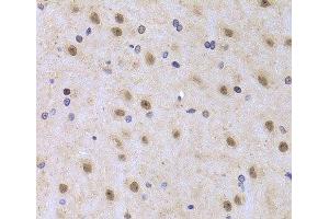 Immunohistochemistry of paraffin-embedded Rat brain using ILF2 Polyclonal Antibody at dilution of 1:100 (40x lens). (ILF2 anticorps)