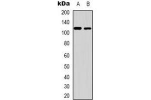 Western blot analysis of ZC3H7B expression in human liver (A), HEK293T (B) whole cell lysates.
