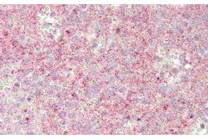 anti-Jagged 1 (JAG1) (AA 33-250) antibody