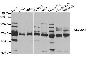 Western blot analysis of extracts of various cells, using SLC20A1 antibody.