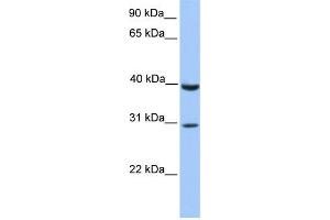 WB Suggested Anti-JAZF1 Antibody Titration:  0. (JAZF1 anticorps  (C-Term))