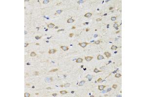 Immunohistochemistry of paraffin-embedded rat brain using CLIC4 antibody (ABIN5974262) at dilution of 1/100 (40x lens). (CLIC4 anticorps)