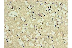 Immunohistochemistry of paraffin-embedded human brain tissue using ABIN7162631 at dilution of 1:100
