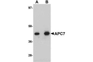 Western blot analysis of APC7 in rat kidney tissue lysate with AP30063PU-N APC7 antibody at (A) 1 and (B) 2 μg/ml. (ANAPC7 anticorps  (C-Term))