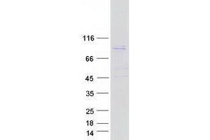 Validation with Western Blot