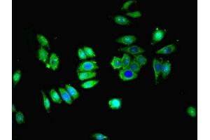 Immunofluorescent analysis of HepG2 cells using ABIN7170032 at dilution of 1:100 and Alexa Fluor 488-congugated AffiniPure Goat Anti-Rabbit IgG(H+L)