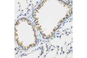 Immunohistochemistry of paraffin-embedded mouse lung using FLT4 antibody (ABIN5973266) at dilution of 1/200 (40x lens). (FLT4 anticorps)