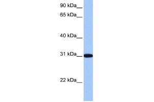 RFPL2 antibody used at 1 ug/ml to detect target protein. (RFPL2 anticorps  (C-Term))