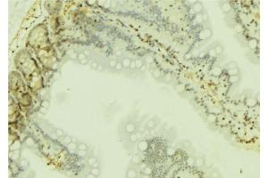 ABIN6274751 at 1/100 staining Mouse colon tissue by IHC-P.