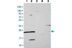 Western blot analysis of Lane 1: RT-4, Lane 2: U-251 MG, Lane 3: Human Plasma, Lane 4: Liver, Lane 5: Tonsil with MRPS26 polyclonal antibody  at 1:250-1:500 dilution. (MRPS26 anticorps)