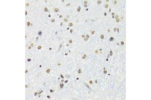 Immunohistochemistry of paraffin-embedded mouse brain using SFPQ antibody.