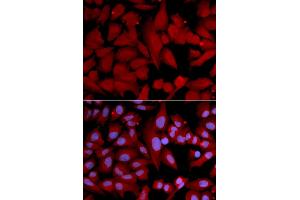 Immunofluorescence analysis of U2OS cells using PSMA4 antibody (ABIN5971344). (PSMA4 anticorps)