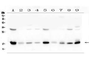 Western blot analysis of TIMM17A using anti-TIMM17A antibody (ABIN6719637).