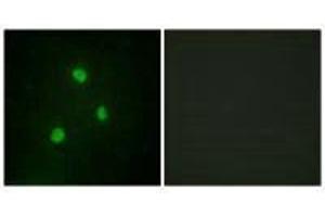 Immunofluorescence analysis of A549 cells, using TBX1 antibody.