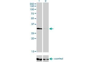 Western blot analysis of HDAC7A over-expressed 293 cell line, cotransfected with HDAC7A Validated Chimera RNAi (Lane 2) or non-transfected control (Lane 1).
