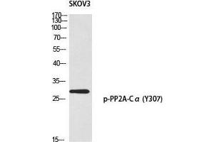 Western Blot (WB) analysis of SKOV3 using p-PP2A-Calpha (Y307) antibody. (PPP2CA anticorps  (pTyr307))
