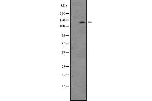 Western blot analysis of TTBK2 expression in Mouse thymus lysate ;,The lane on the left is treated with the antigen-specific peptide. (TTBK2 anticorps  (C-Term))