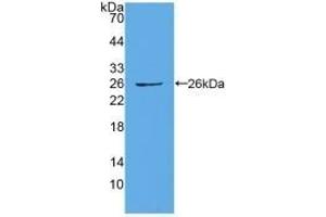 Detection of Recombinant CX43, Human using Polyclonal Antibody to Connexin 43 (CX43)