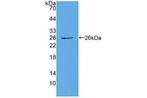 Detection of Recombinant CX43, Human using Polyclonal Antibody to Connexin 43 (CX43) (Connexin 43/GJA1 anticorps  (AA 244-382))