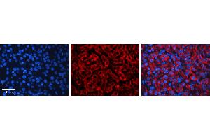 Immunohistochemistry (IHC) image for anti-Cytochrome P450, Family 3, Subfamily A, Polypeptide 4 (CYP3A4) (C-Term) antibody (ABIN2783886)