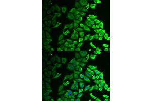 Immunofluorescence analysis of A549 cells using IL18BP antibody (ABIN5973845). (IL18BP anticorps)