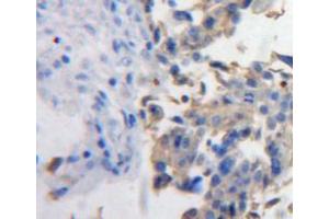 Used in DAB staining on fromalin fixed paraffin-embedded ovary tissue (PDGFD anticorps  (AA 19-370))