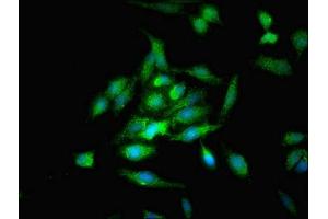 Immunofluorescent analysis of Hela cells using ABIN7162247 at dilution of 1:100 and Alexa Fluor 488-congugated AffiniPure Goat Anti-Rabbit IgG(H+L)