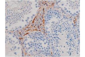 ABIN6267471 at 1/200 staining Mouse testis tissue sections by IHC-P. (AKT1 anticorps  (pSer124))