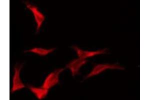 ABIN6276092 staining HeLa by IF/ICC.