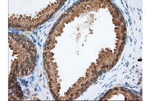 Immunohistochemical staining of paraffin-embedded Human pancreas tissue using anti-PDE4A mouse monoclonal antibody. (PDE4A anticorps)