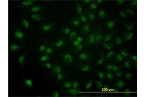 Immunofluorescence of monoclonal antibody to CDC14A on HeLa cell.