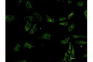 Immunofluorescence of monoclonal antibody to STK3 on HeLa cell.