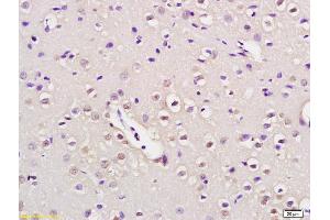 Formalin-fixed and paraffin embedded rat brain labeled with Anti-NUP50 Polyclonal Antibody, Unconjugated (ABIN873330) at 1:200 followed by conjugation to the secondary antibody and DAB staining (NUP50 anticorps  (AA 351-450))