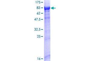 Image no. 1 for Rab Geranylgeranyltransferase, alpha Subunit (RABGGTA) (AA 1-567) protein (GST tag) (ABIN1317238)