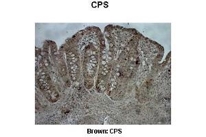 Sample Type :  Pig ileum   Primary Antibody Dilution :   1:500  Secondary Antibody :  Anti-rabbit-biotin, streptavidin-HRP   Secondary Antibody Dilution :   1:500  Color/Signal Descriptions :  Brown: CPS  Gene Name :  CPS1  Submitted by :  Juan C.