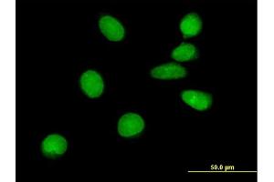 Immunofluorescence of purified MaxPab antibody to ASCIZ on HeLa cell. (ATM Interactor anticorps  (AA 1-667))