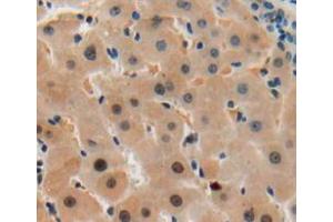 IHC-P analysis of liver tissue, with DAB staining. (SGK2 anticorps  (AA 40-311))