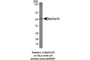 Image no. 1 for anti-Heat Shock 70kDa Protein 5 (Glucose-Regulated Protein, 78kDa) (HSPA5) (AA 250-300), (Internal Region) antibody (ABIN363671) (GRP78 anticorps  (Internal Region))