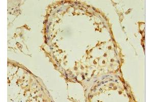 anti-Testis Specific, 13 (TSGA13) (AA 1-275) antibody