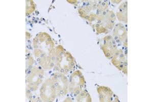Immunohistochemistry of paraffin-embedded human stomach using ATP2C1 antibody (ABIN5975353) at dilution of 1/100 (40x lens). (ATP2C1 anticorps)