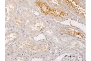 Image no. 1 for anti-S100 Calcium Binding Protein A5 (S100A5) (AA 1-91) antibody (ABIN598911) (S100A5 anticorps  (AA 1-91))